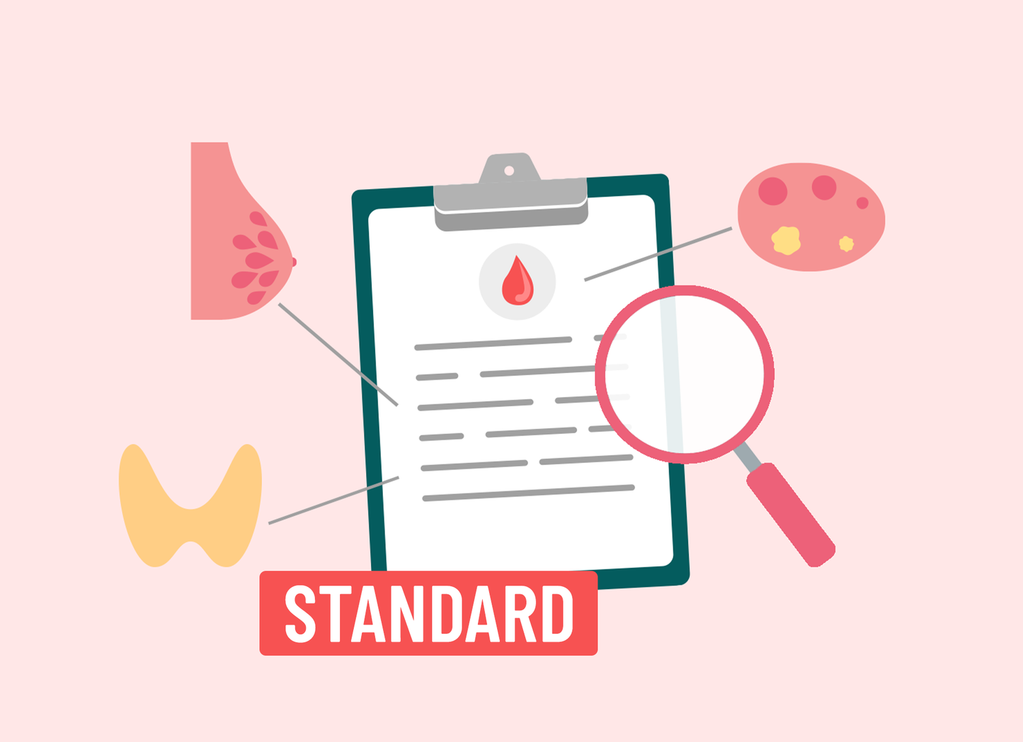 PCOS Blood Test Review [Standard]